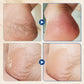 🎉Buy 2 Get 3 Free🎉Hydrating and Anti-Cracking Foot Cream