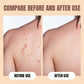 🎁Hot Sale 49% OFF🔥Deep Cleansing Moisturizing Sulfur Body Wash
